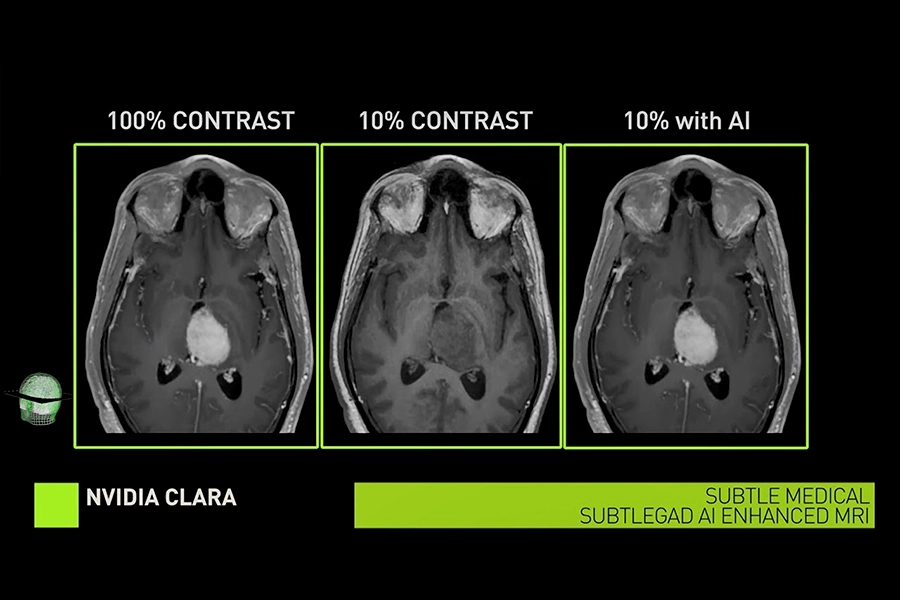 NVIDIA Clara Imaging AI-assisted medical image segmentation and 3D reconstruction from CT and MRI scans