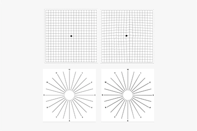 Eye-Q check feature.