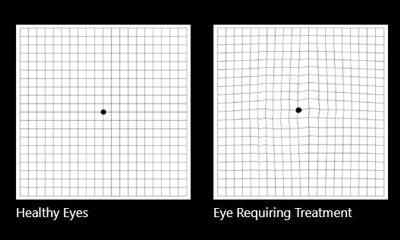 Amsler Grid feature, providing eye advice.