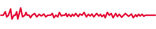 obsbot tail 2 vibration pattern